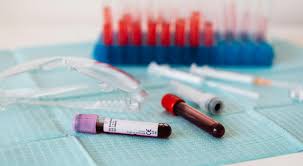 Picture How to Order Blood Tests Online